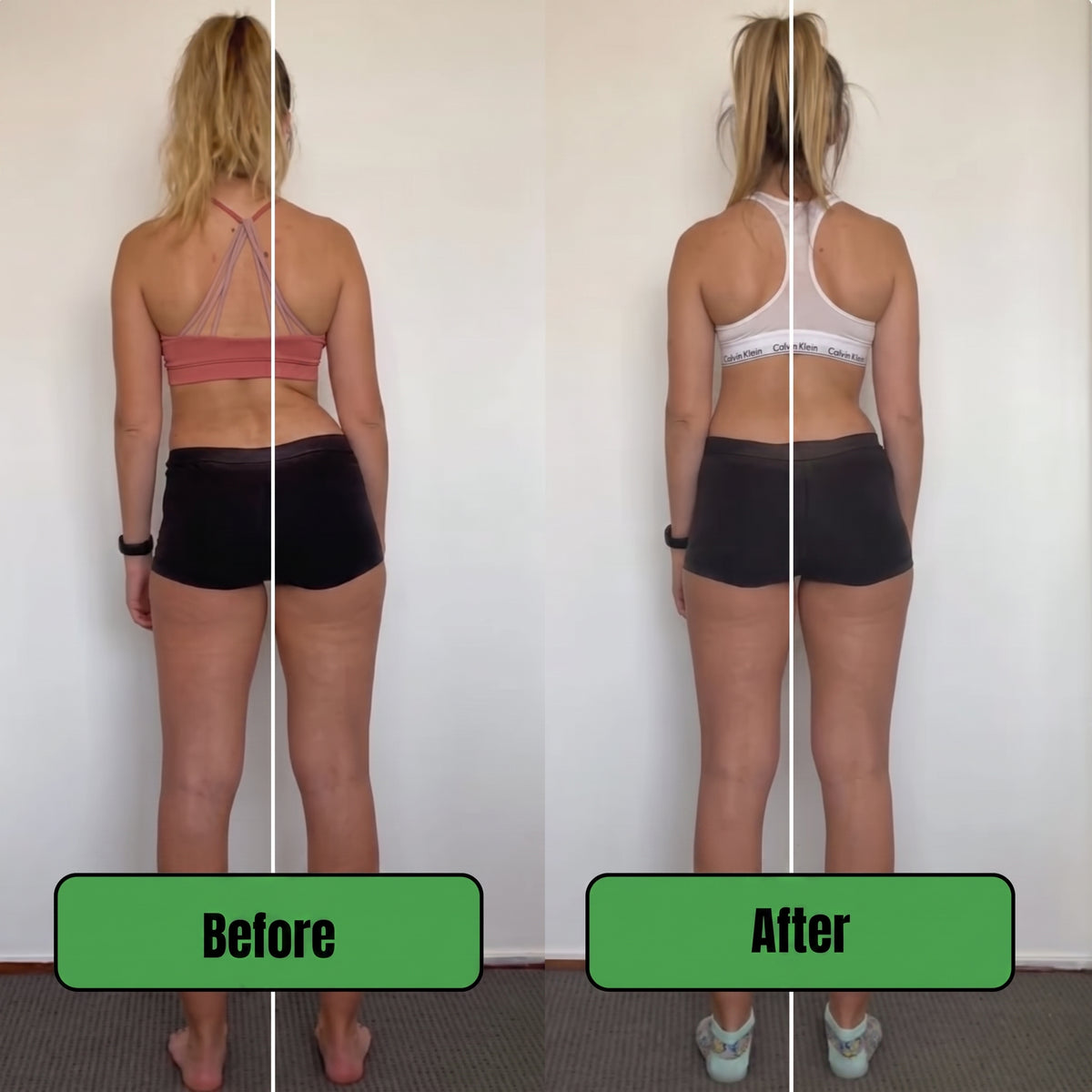 Adjustable Posture Corrector Belt for Youth